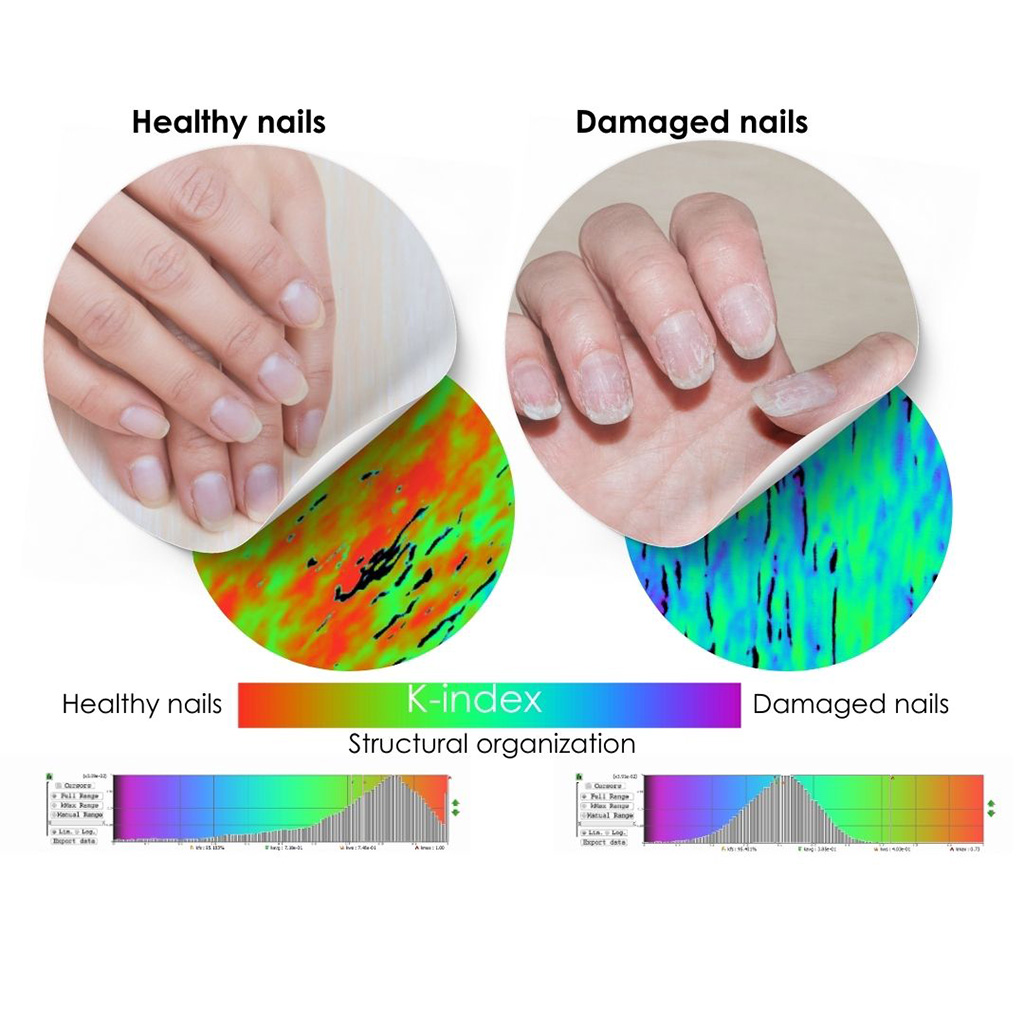 Ongles protection