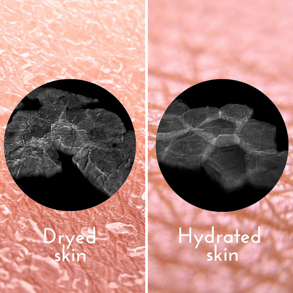 Peau hydratation
